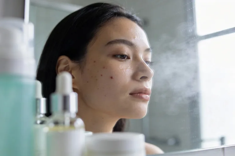 Your No-Panic Guide to How to Fix Stress-Related Breakouts