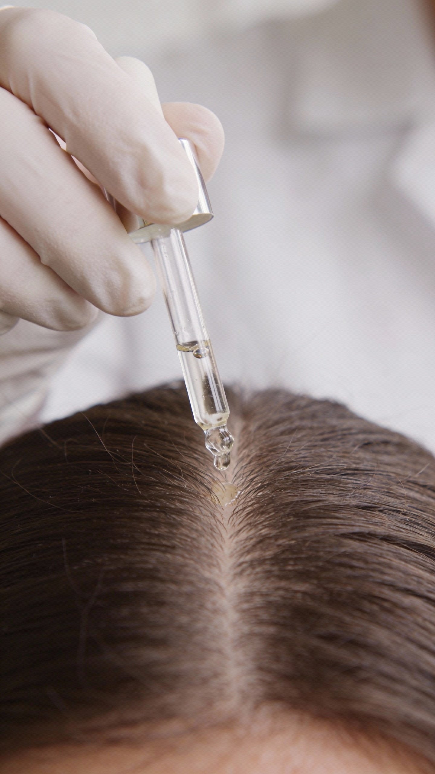 dermatologist’s hand applying clarifying scalp serum dropper on part line